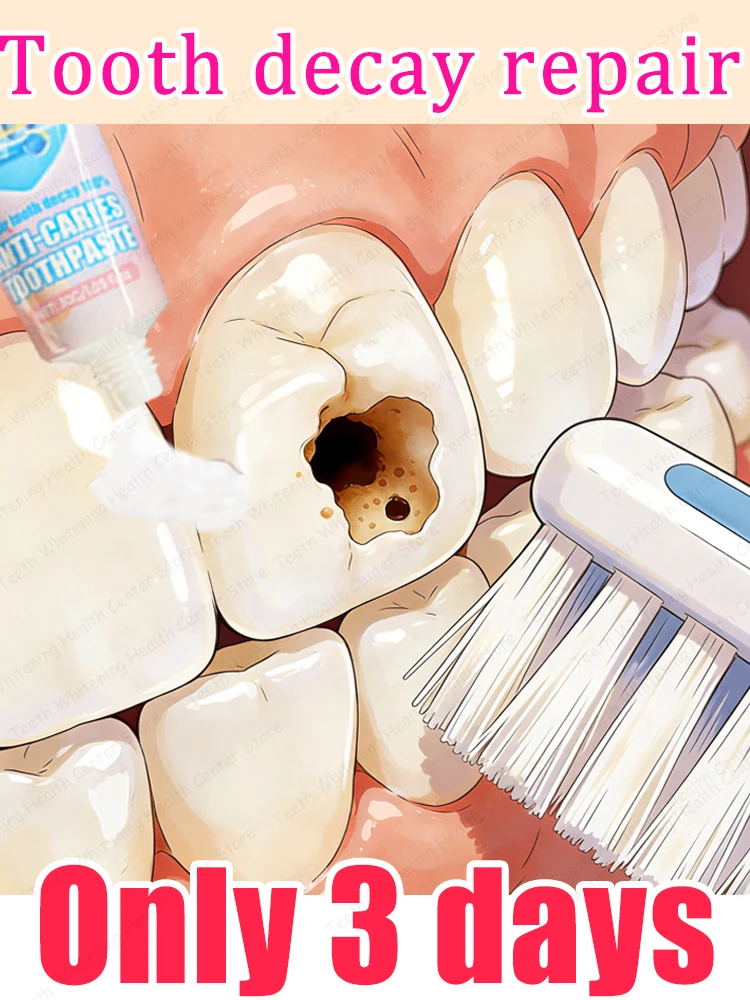 Brush your teeth twice a dayᵃᵛⁱᵗⁱᵉˢ ᶜᵃⁿ ᵇᵉ ᵉᵃˢⁱˡʸ ʳᵉᵖᵃⁱʳᵉᵈ ⁱⁿ 3ᵈᵃʸˢAdvanced Cavity Protection Toothpaste – Gentle Daily Care for Sensitive Teeth, Strengthens Enamel, Fights Plaque & Tartar,Prevents Tooth Decay Naturally