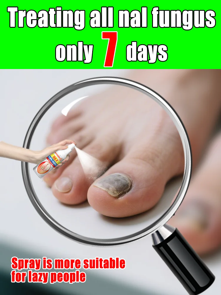 

The most powerful black technology in 2025,ᵉᶠᶠᵉᶜᵗⁱᵛᵉ ⁿᵃⁱˡ ᶠᵘⁿᵍᵘˢ ᵗʳᵉᵃᵗᵐᵉⁿᵗ⸴ ʳᵉˢᵗᵒʳᵉ ⁿᵃⁱˡ