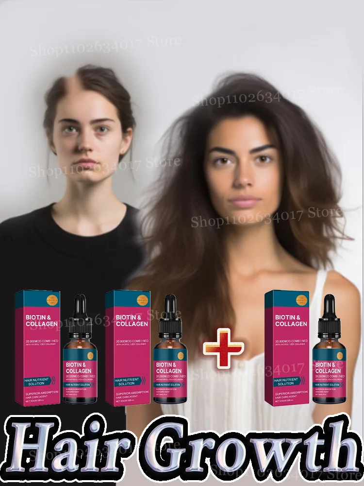 

Nutritional Supplements for Accelerating Hair Growth