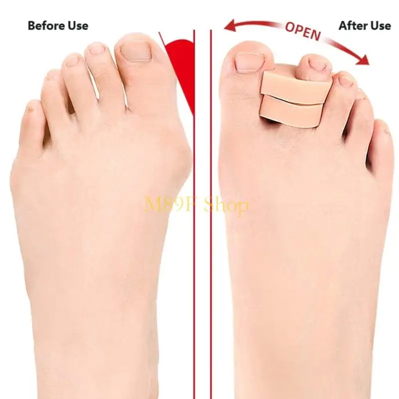 M89F Reusable SEBS Toe Splints Correctors Separators 4Pairs All Day Comfort and Foot Health