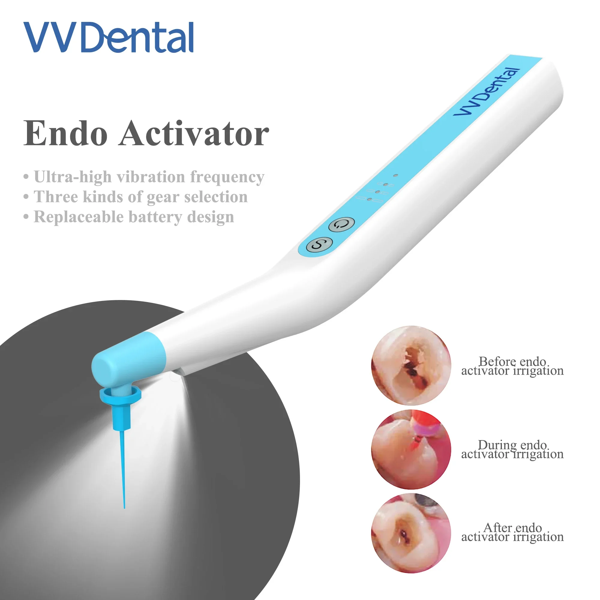 Endo Activators Dentals Root Canals Sonics Irrigators LED With 60Pcs Tips Endomotors File for Endodontics Cleanings Irrigatings