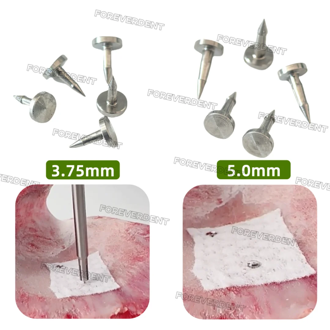 Picture 6: 13pcs GBR Bone TAC Automatic Gun Tacker Gun Tack Blue Case Membrane Guide MCTBIO Type Regeneration Tacks Pins