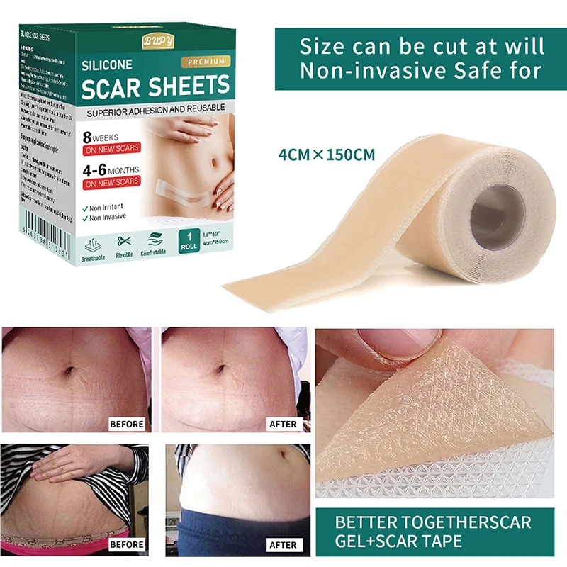 1 Roll Silicone Scar Sheets Gel Scar Patch 4cmX150cm Self-Adhesive Scar Cover Tape Reusable And Effective Skin Care Strips