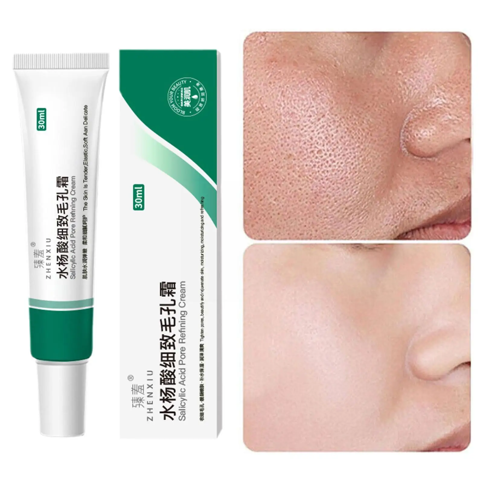 Krim penghilang jerawat asam salisilat 30ml, produk krim perawatan anti-penuaan penghilang penghalus Korea mengecilkan pori-pori minyak komedo Sk K5i3