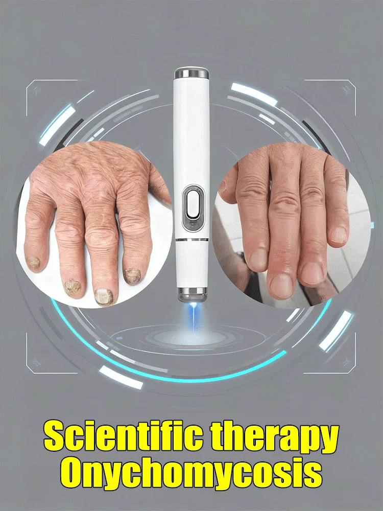 

2025 New Blue Laser care Nail Fungi