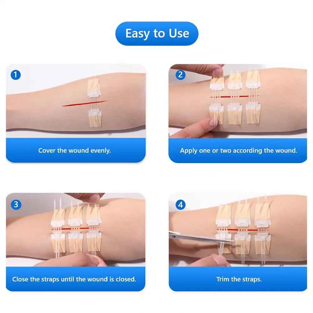 3Pcs/set Band-Aid Zipper Tie Wound Closure Patch Hemostatic Wound Patch Fast Suture Portable Zipper Band-Aid First Aid Kits