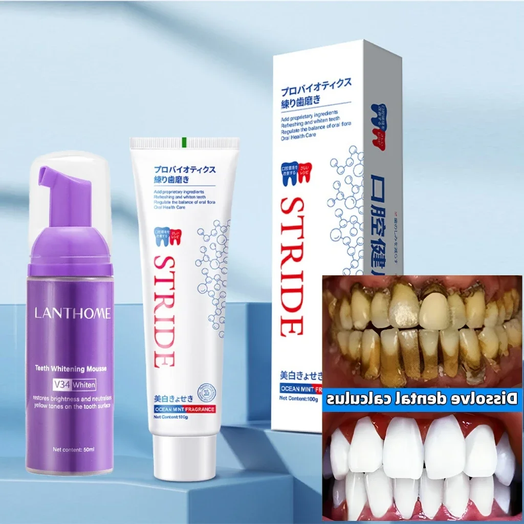 Dental Calculus Remover Whitening Teeth Mousse Toothpaste Mouth Odour Removal Bad Breath Preventing Periodontitis Oral Products