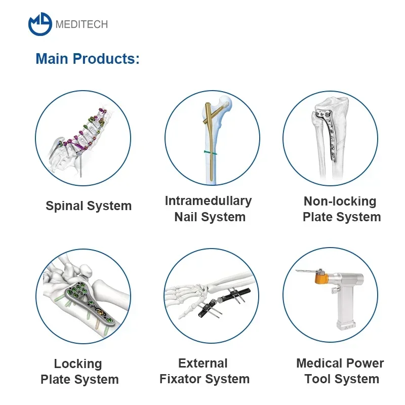 High Strength, Versatility, Medical Disposable Uhmwpe Suture Suture For Femoral Cortical Fixation Sterile Non Absorbable Suture