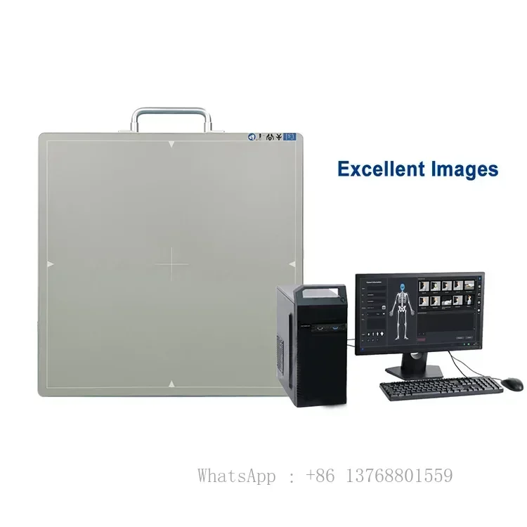 Xray 14 * 17 Inch Wireless Flat Panel DR Detector X Ray Wireless DR Digital X-ray Flat Detector Panel