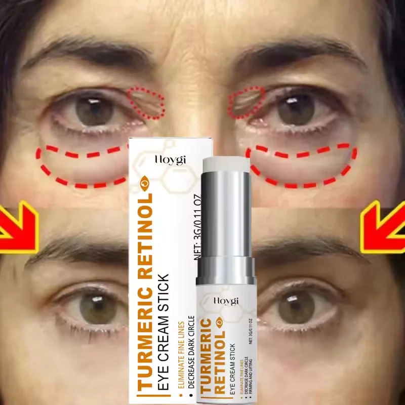 

Instant Eye Bag Removal Cream Collagen Anti-Wrinkle Lifting Firm Fade Fine Lines Remove Dark Circle Puffiness Brighten Eye Care