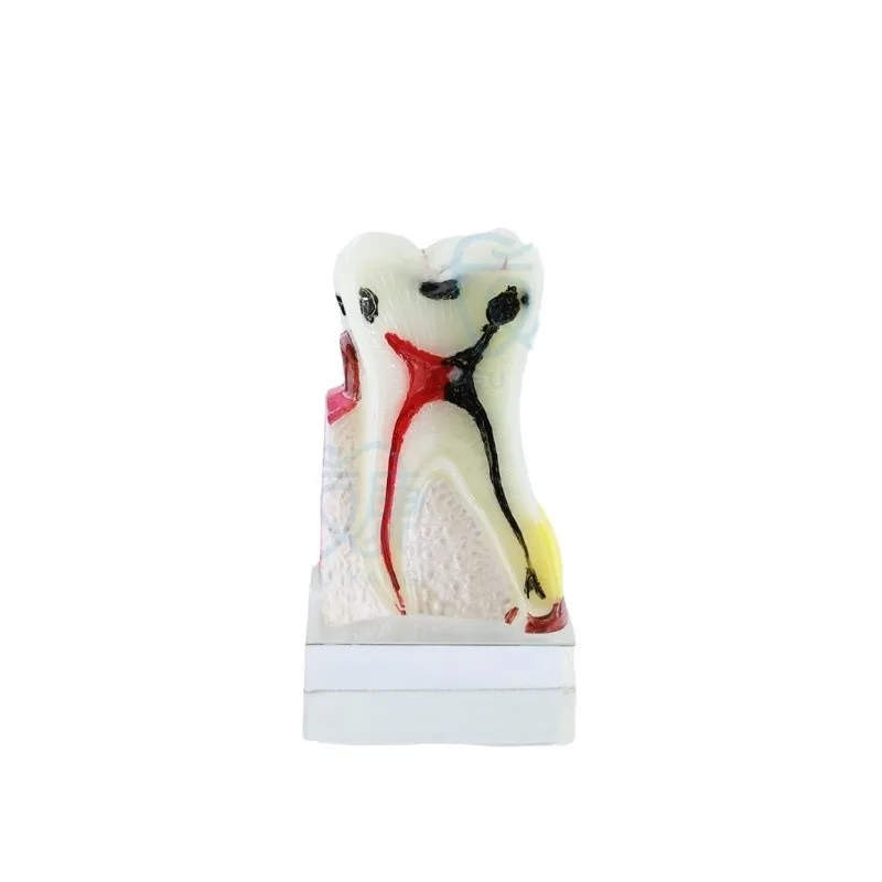 4X Comprehensive Pathology  Teaching  Dental  Oral Practice Demonstration Model