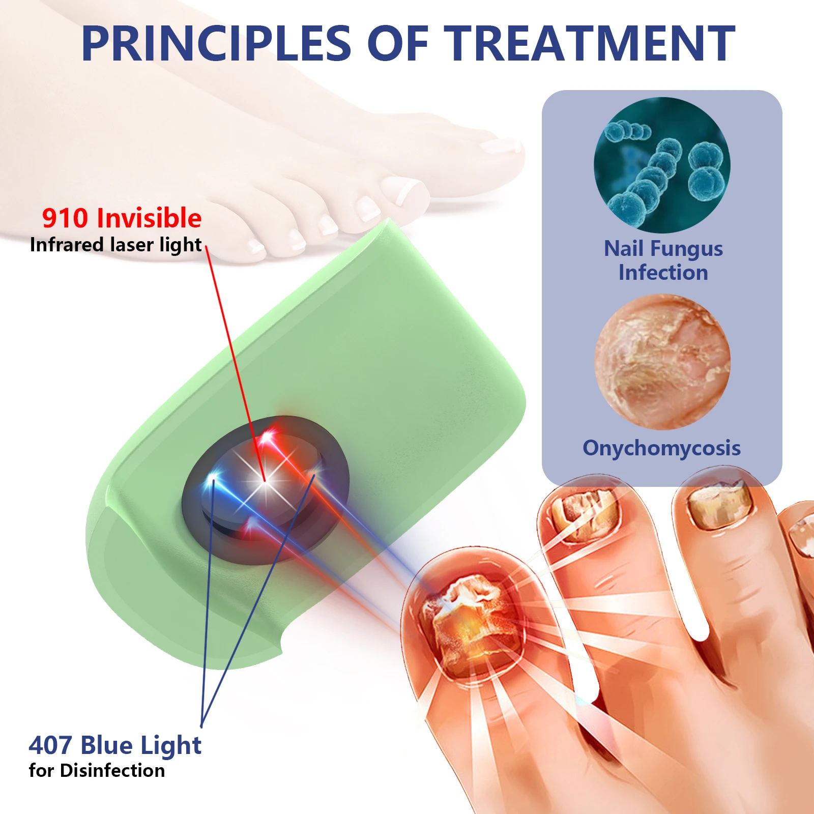 KTS Anti Fungal Laser Device Home Nail Laser Therapy Device for Nail Fungus Infection Onychomycosis Cure Machine 905nm 470nm USB