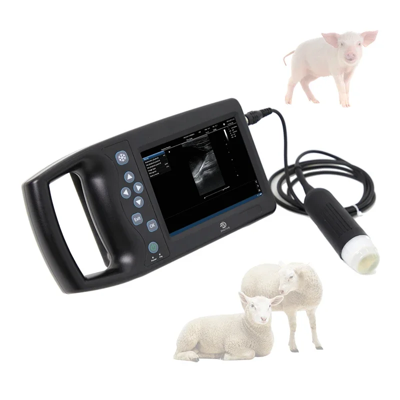 Cheap 3D Doppler Ultrasound Machine/portable Ultrasound Machine With One Probe