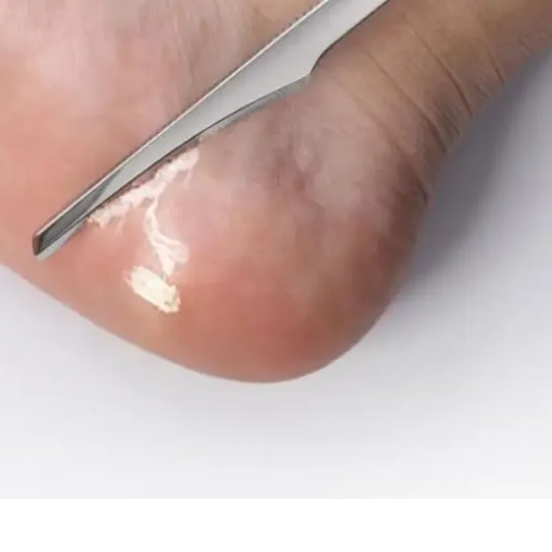 5Pcs Professional Foot Scraper Stainless Steel Foot Care Pedicure Scraper Portable Foot Exfoliating Dead Skin Calluses Tools