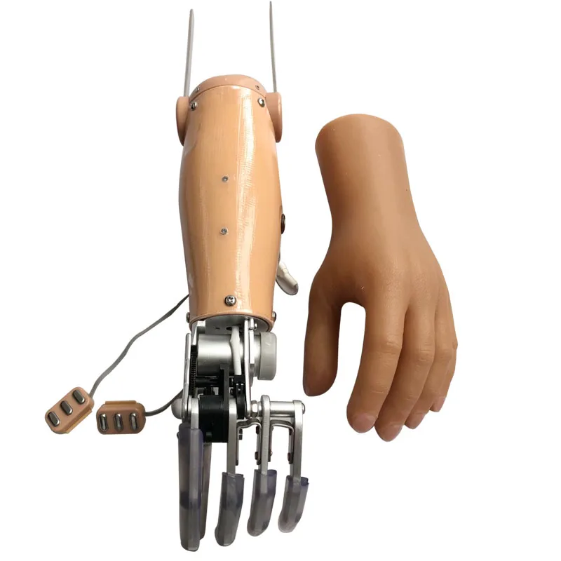 Prosthetic Limb Myo hand elbow disarticulation two degree freedom Artificial Limb Prosthetic Hand