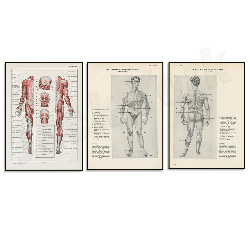 Vintage 1950's Pain Point Anatomy Print, 1962 Muscle Medical Pressure, Antique Hu's Anatomy Poster, Medical Wall Art Medical Gif