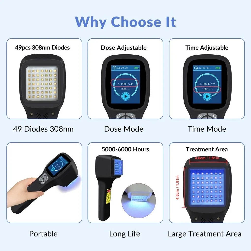 Handheld 308nm UVB Phototherapy Device 49 Diodes Targeted Light Therapy for Vitiligo Psoriasis Dermatitis Rechargeable