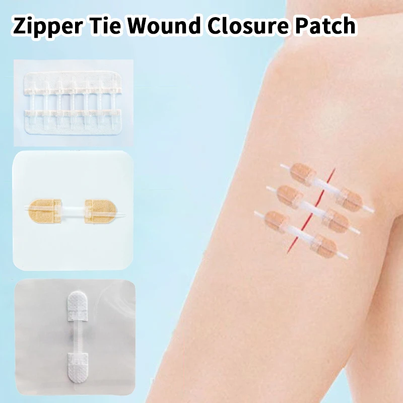 Zíper gravata fechamento de ferida remendo hemostático ferida sutura rápida zíper band-aid ao ar livre ataduras portáteis para cuidados com feridas