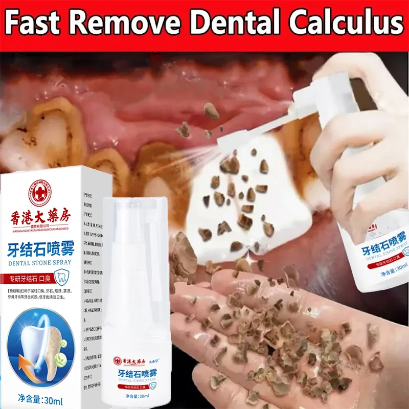 Dissolvant de calcul dentaire, Spray de blanchiment des dents, haleine fraîche, dentifrice, nettoyage, hygiène buccale, élimination des taches de Plaque d'halitose