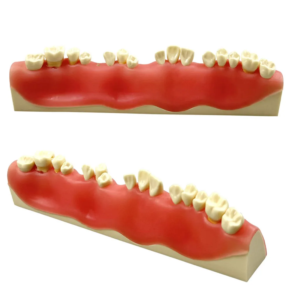 

Модель для стоматологической подготовки, модель корня абсссы, модель для экзаменационной практики, модели для экзаменации Апококтомии, обучение, исследование стоматологии, обучение
