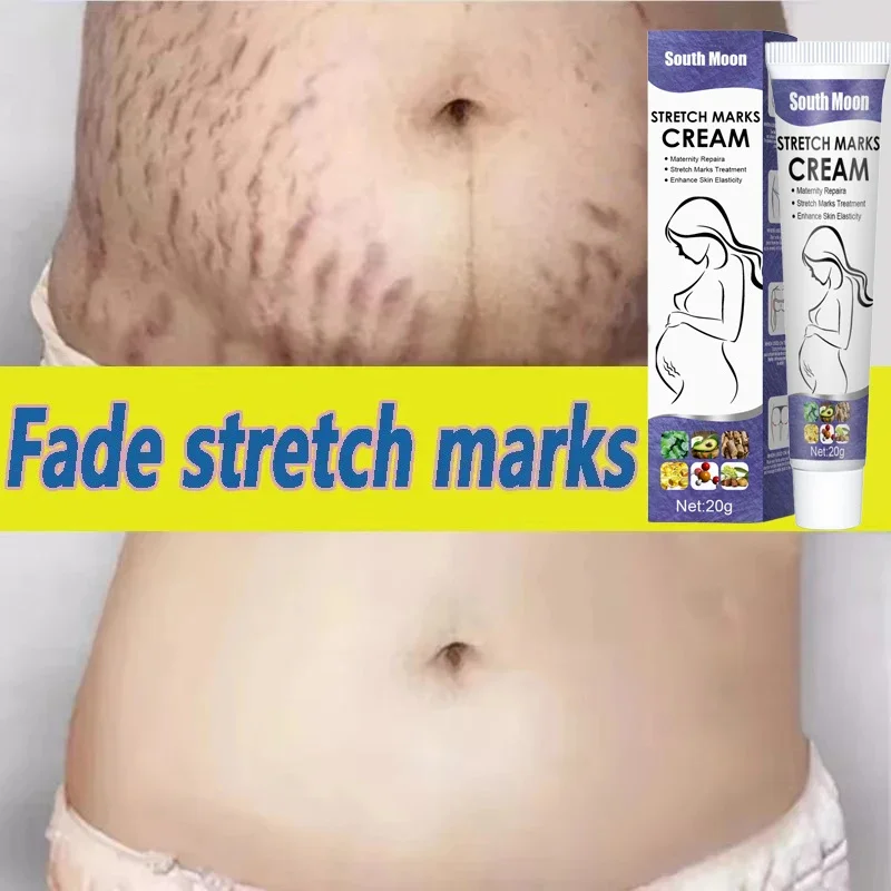 

Stretch Marks Permanent Removal Cream Maternity Pregnant Women Pregnancy Anti-Winkle Smooth Repair Firming Skin Body Skin Care