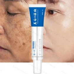 Schiarente Melasma crema per la cura della pelle rimozione pigmento scuro illumina la crema per il viso Nicotinamide illumina la dissolvenza melanina Chloasma emulsione