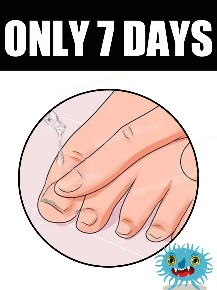 若返り - 真菌予防テクノロジー - 調整可能な制御および安全センサー Hot68