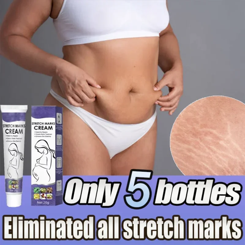 

Skin Care Improves Elasticity Effective After Pregnancy Stretch Marks Removal Powerful Maternity Cream Nourishes Skin