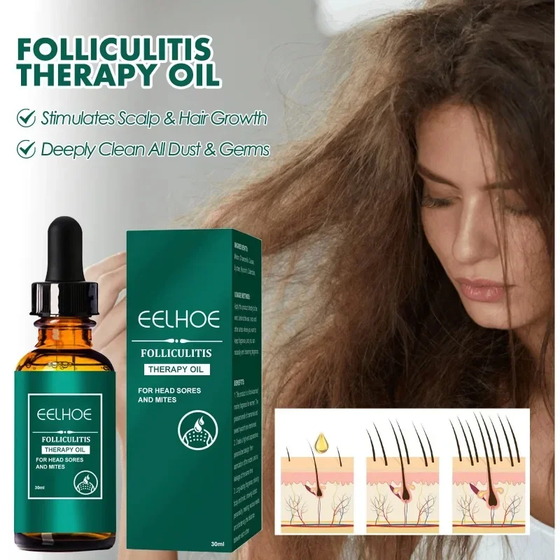 Óleo Essencial de Crescimento Rápido para Homens e Mulheres, Produtos de Regrota do Cabelo Gengibre, Soro, Previne o Desbaste, Reparação Seca, Frizzy, Refrescante