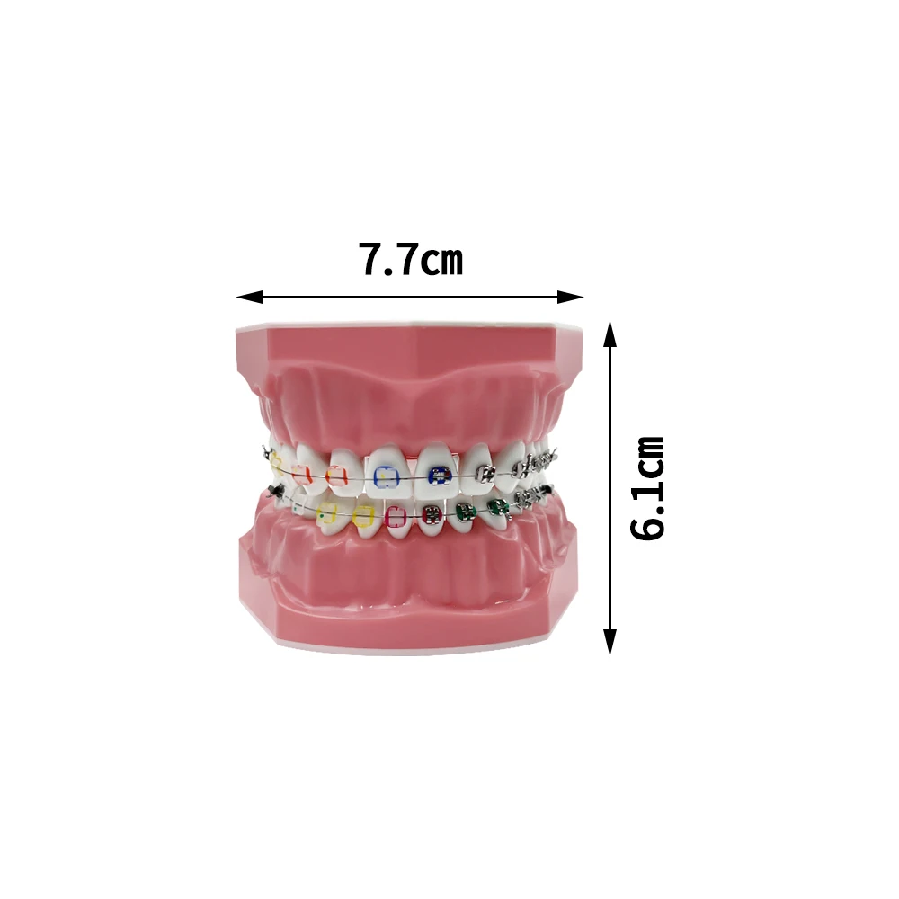 Half Metaal Half Keramisch Tandheelkundig Orthodontisch Gebit Model Met Beugel Standaard Tandheelkundig Onderwijsmodel Voor Het Bestuderen Van Onderwijs