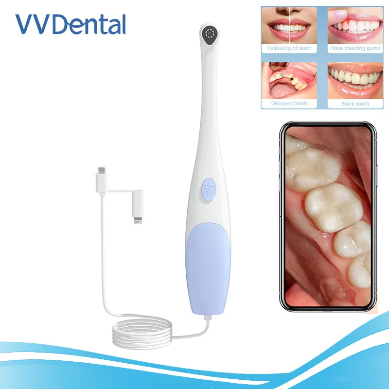 

Dental Camera 1140P Intraoral Camera Visual Dental Instruments 8 PCS LED Lights Support Iphone lpaid and TYPE-C Android Phones