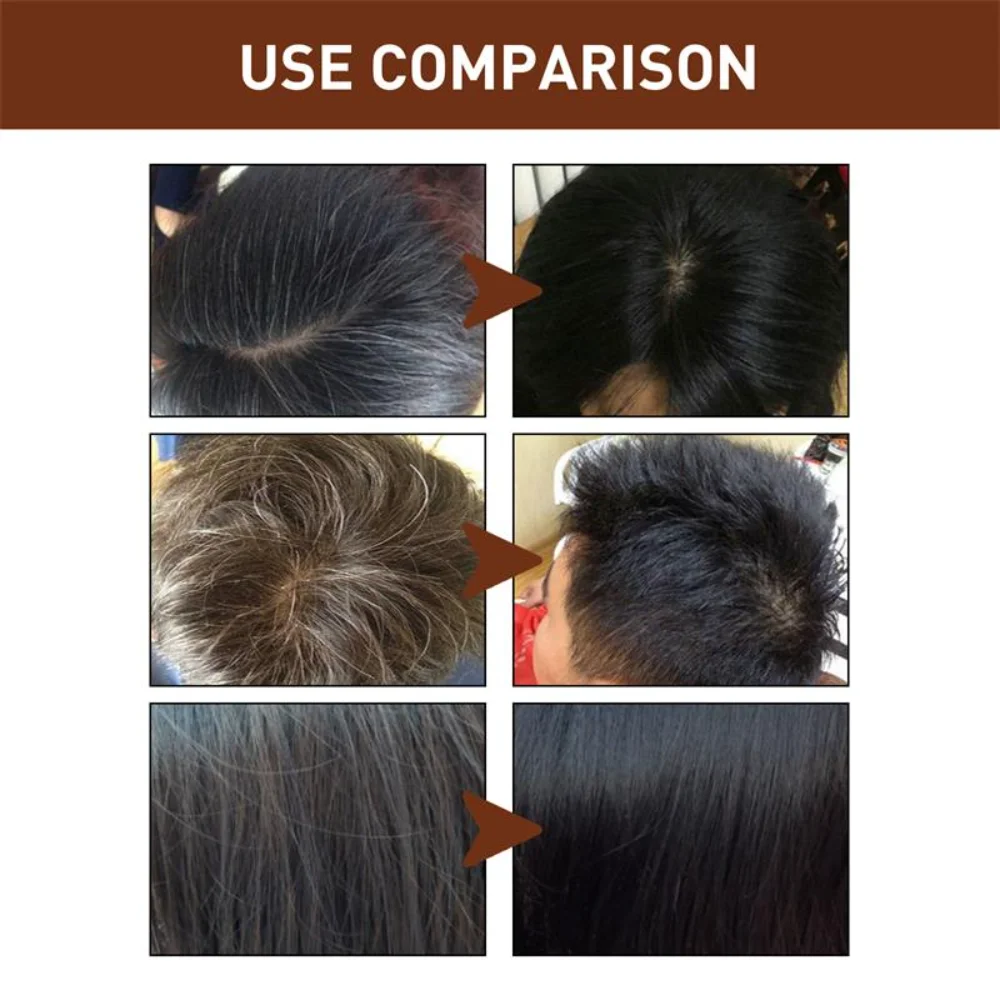 White To Black Hair Serum Gray White Hair Treatment Liquid Natural Color Repair Nourish Anti Loss Hair Care Product Men Women