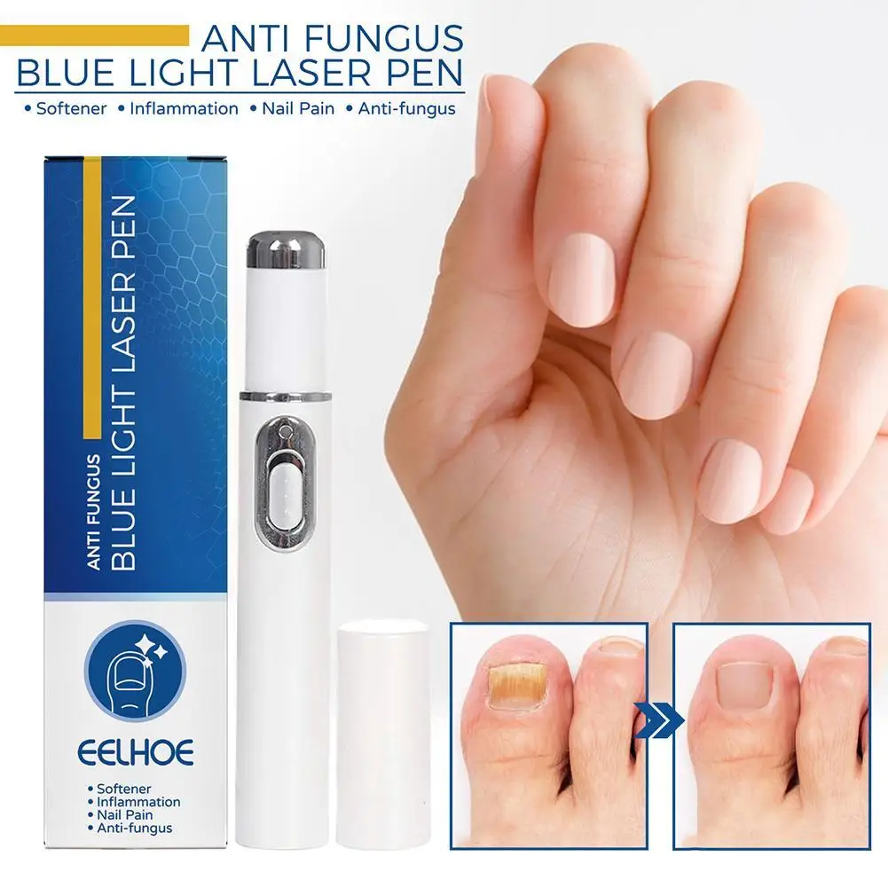 1Pcs Nail Fungus Treatment Pen Anti-fungal Repair Pen Blue Light Laser Pen Paronychia Onychomycosis Painless Nail Repair Kit