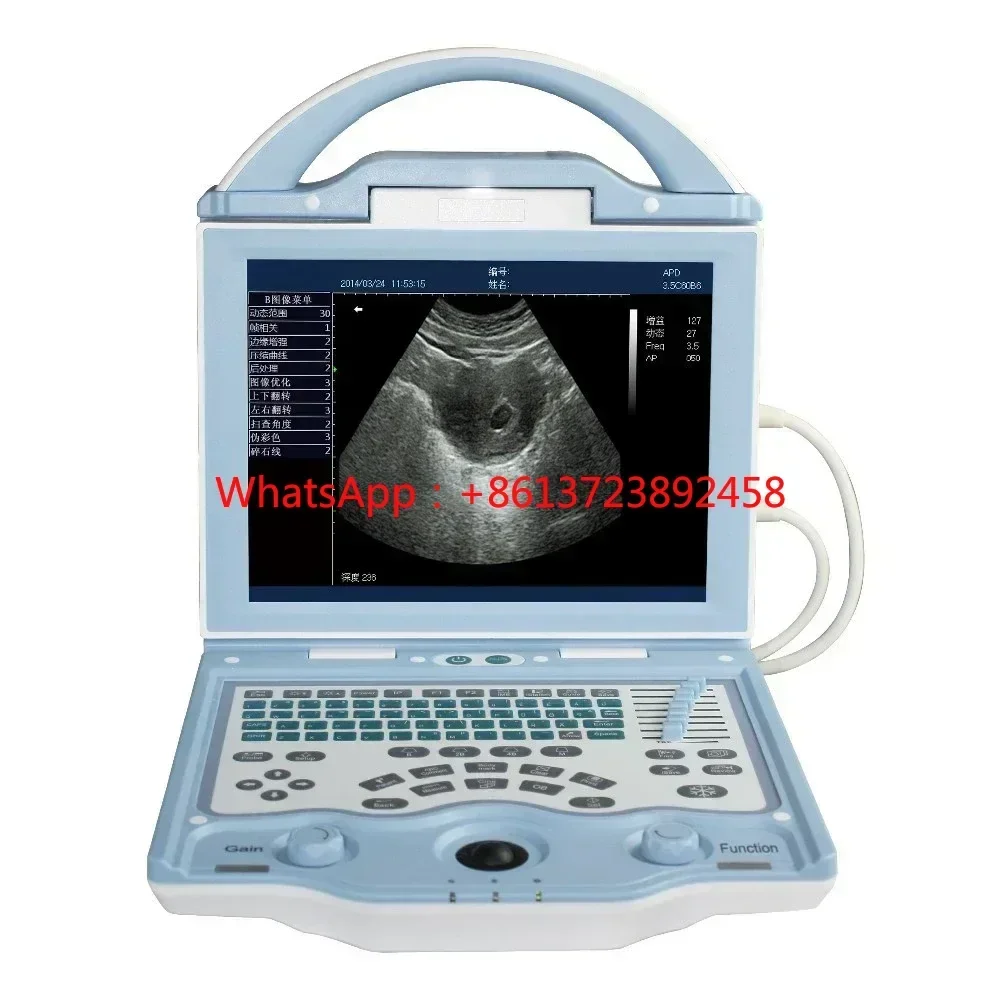 2016 new launches Price Health Diagnostic Ultrasound machines SUN-800W