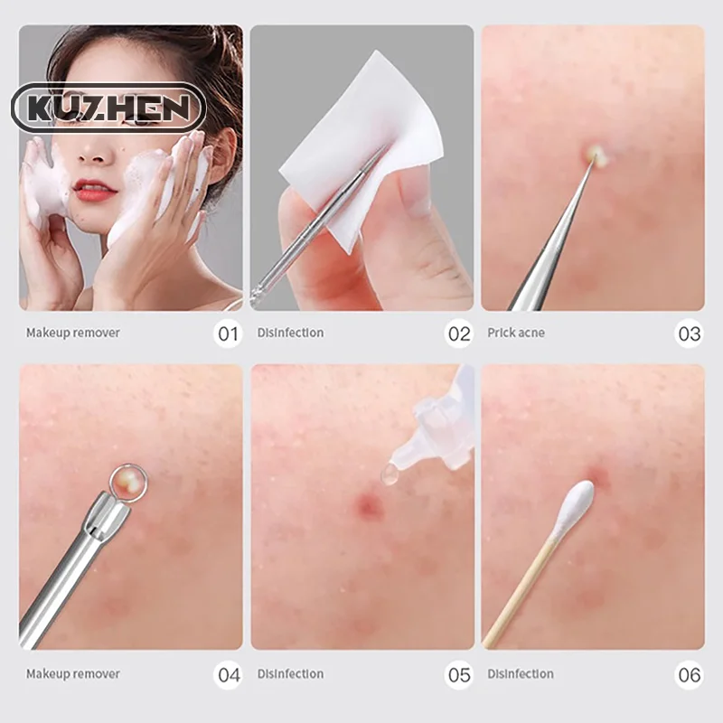 Black Dot Pimple Blackhead Remover Tool Needles For Squeezing Acne Tools Spoon For Face Cleaning Comedone Extractor Pore Cleaner