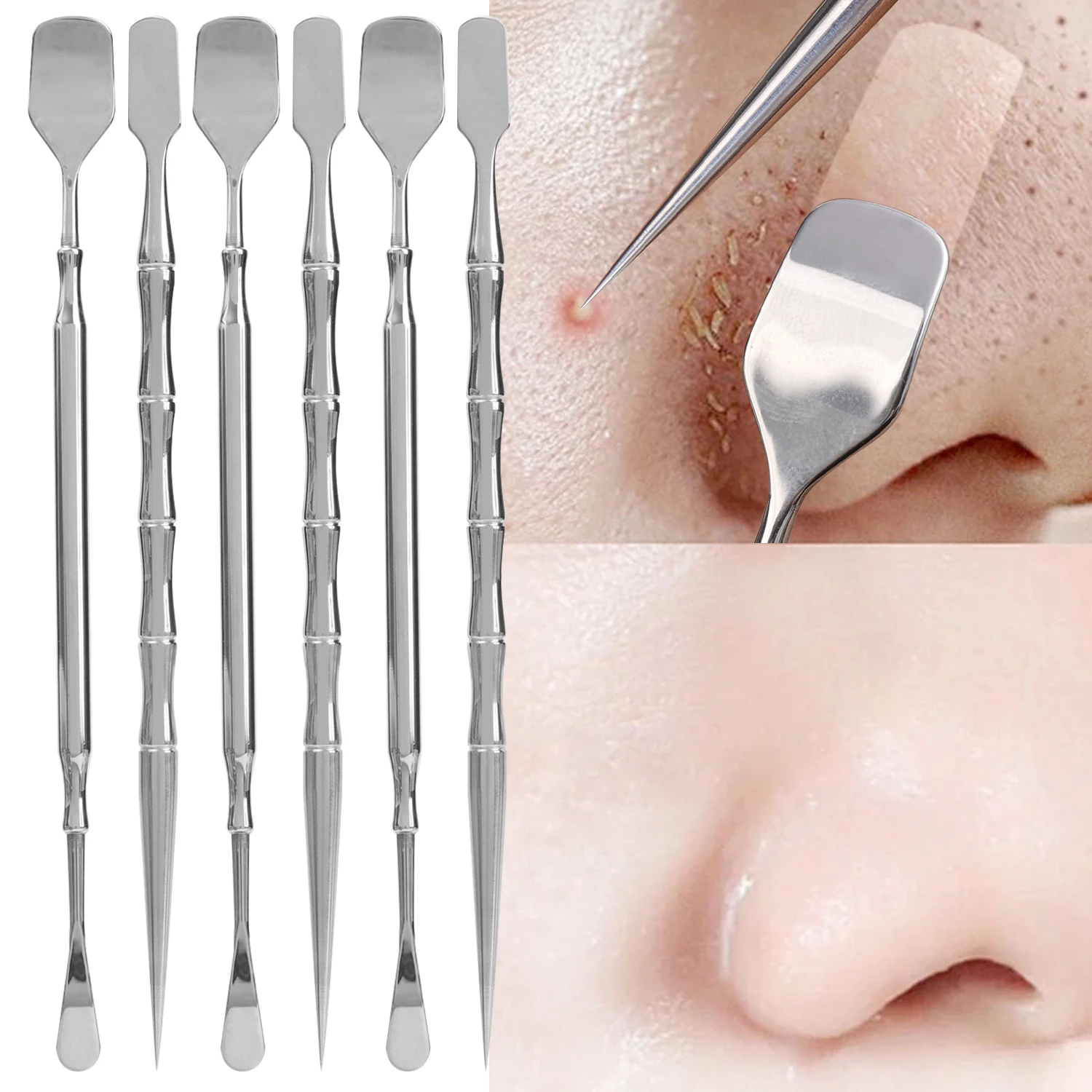 Stainless Steel Blackhead Scraper Acne Needle Removal Treatment Face Pore Cleaning Massage Beauty Shovel Face Blemish Care Tool