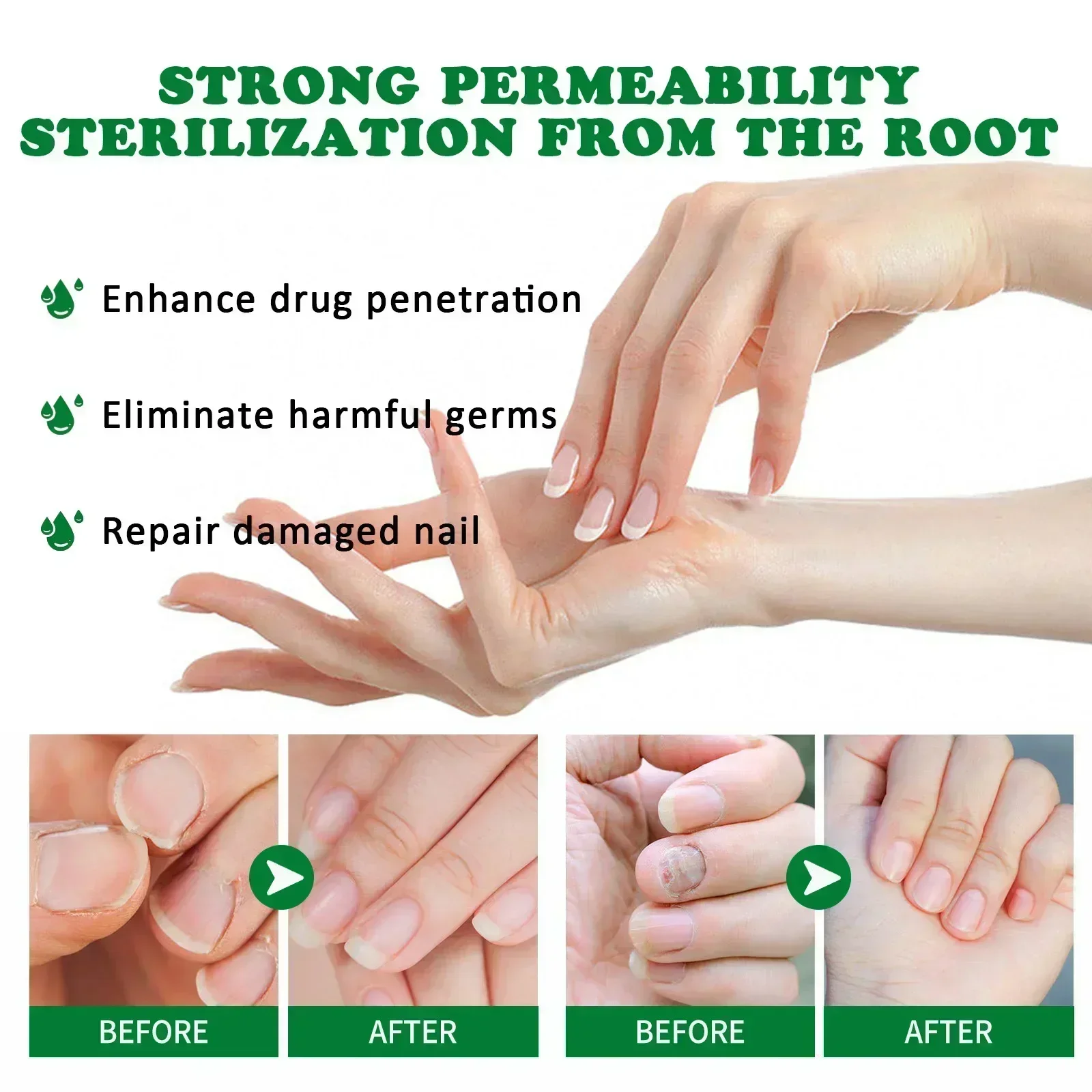 Strong Nail Fungus Treatment Serum Essence oil Feet Nails Repair Care Essence Cream Anti Infection Toe Fungal Removal