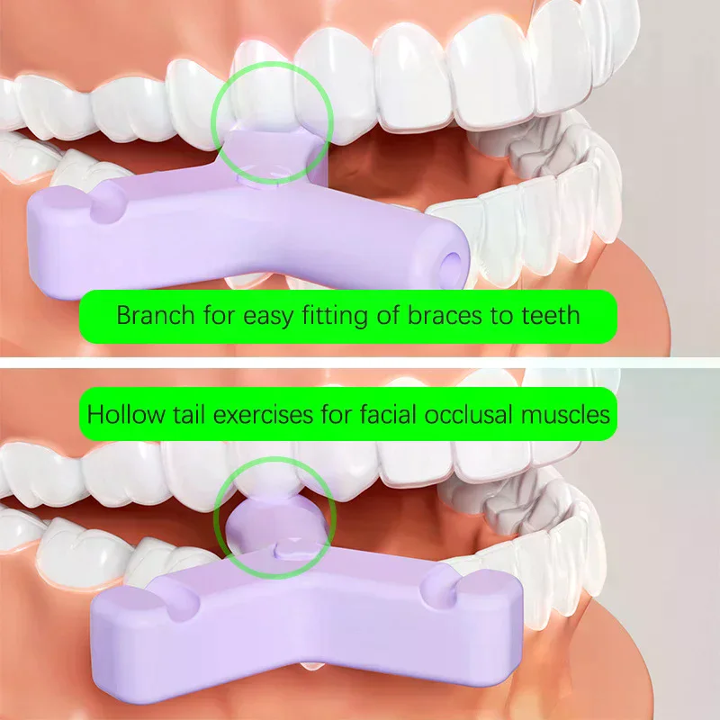 1/4PCS Dental Aligner Chewies Silicone Teeth Stick Bite  Bite Chewies Prevent Face Distortion Y Shaped