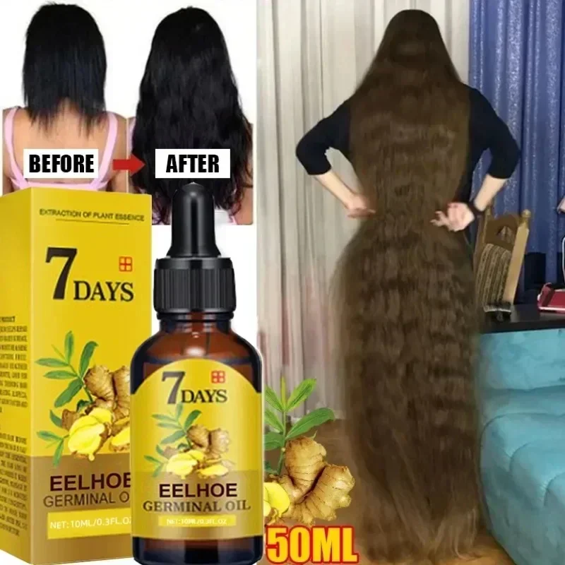 Aceite de crecimiento rápido del cabello para hombres y mujeres, suero para el crecimiento del cabello, jengibre, tratamiento anticaída del cabello, productos de belleza, 7 días