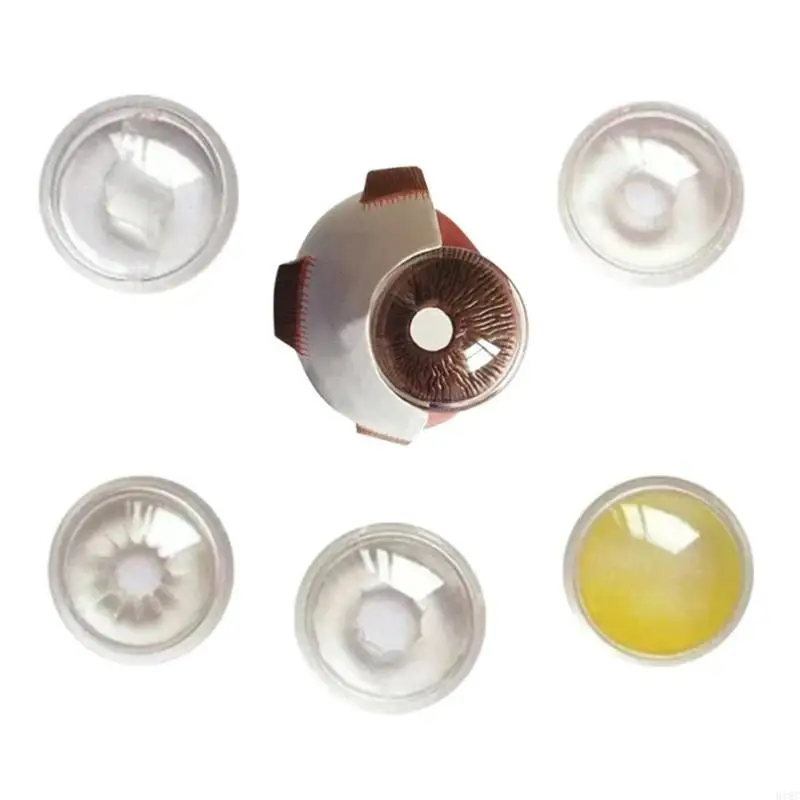 Menschliches pathologisches Augapfel Modell pathologisches Augapfel -Anatomie -Modell zum Unterrichten von Demonstration