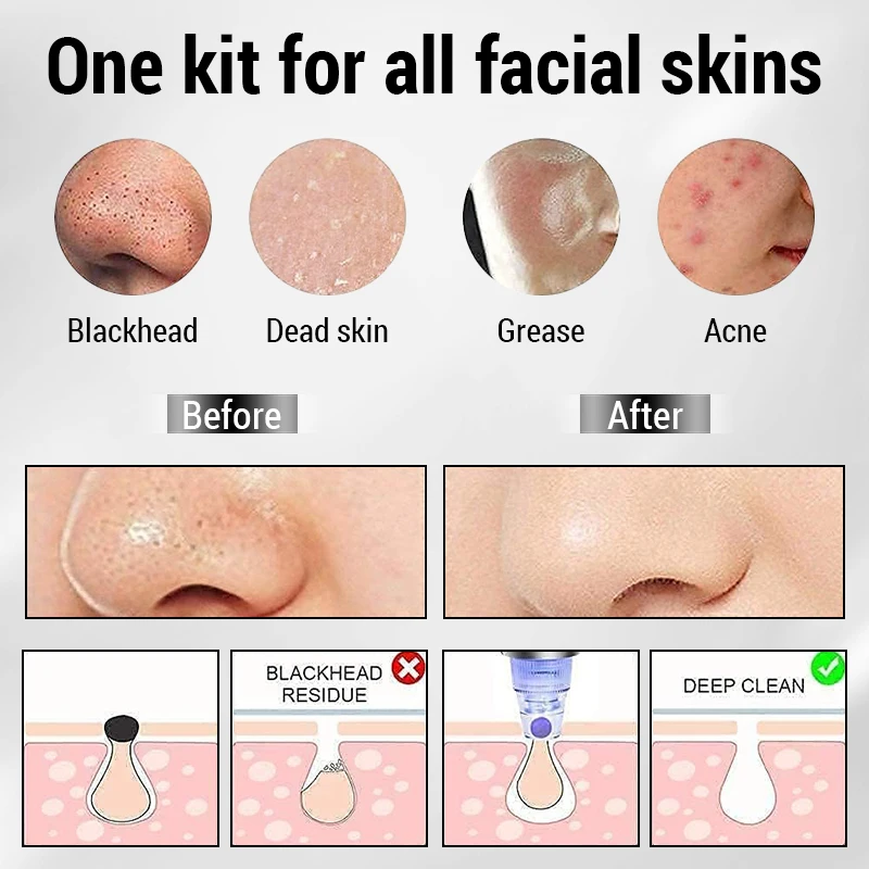 3 en 1 aspiration points noirs dieu points noirs électriques Instrument Go points noirs visage pores nettoyage Instrument de beauté outils de soins de la peau