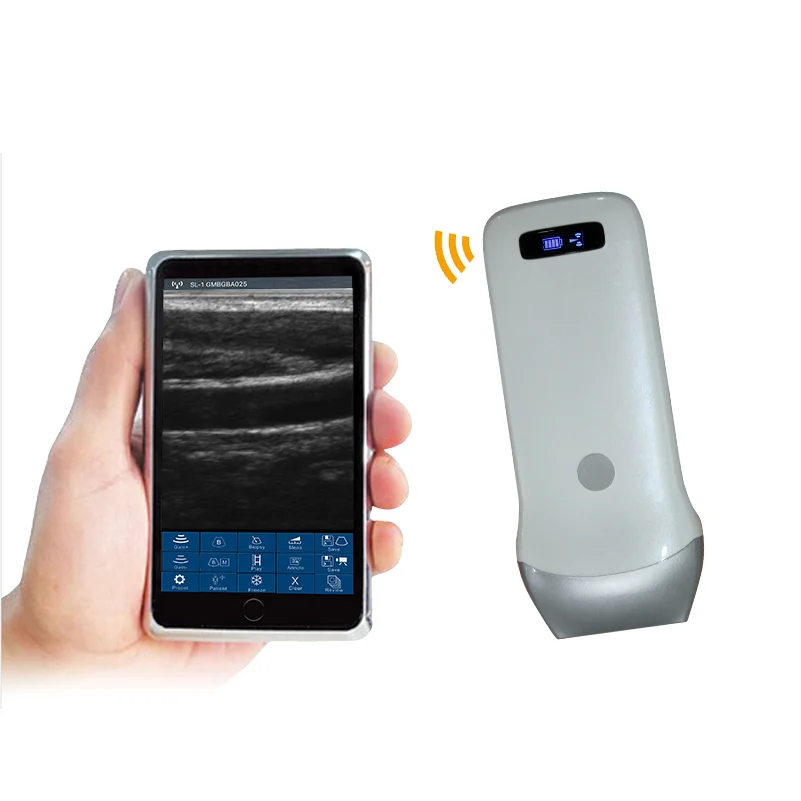 

Medical Devise Mini Portable Wireless Handheld Convex Linear Probe Ultrasound Scanner