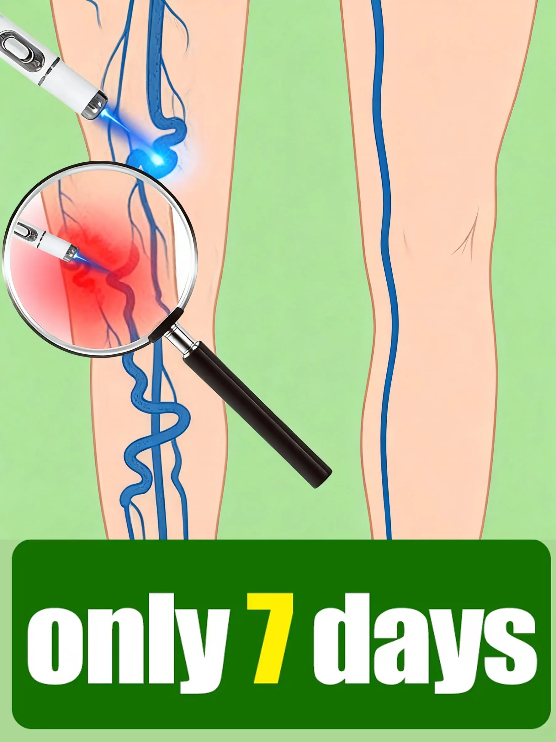 

Ручка Unisx с синим светом 2024 года решает варикозное расширение вен, горячая распродажа, инструменты для ухода за ногами, удаление паукообразных ног в течение 7 дней