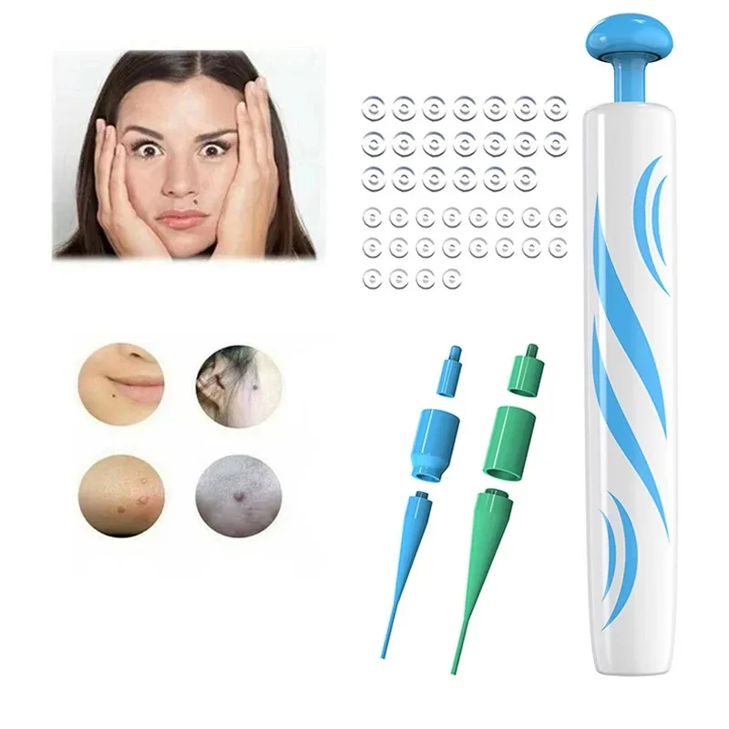 2-IN-1 السيارات الجلد علامة أداة إزالة الصواميل عدة غير مؤلم الجلد التسمية الخلد حب الشباب الثآليل إزالة القلم مع مسحات التطهير أداة العناية ببشرة الوجه #5