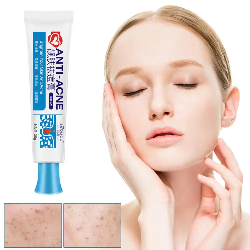 25G Acne Verwijderingscrème Anti-Acne Gel Effectieve Behandeling Puistje Spot Litteken Mee-Eterolie Controle Vochtinbrengende Crème Huidverzorging