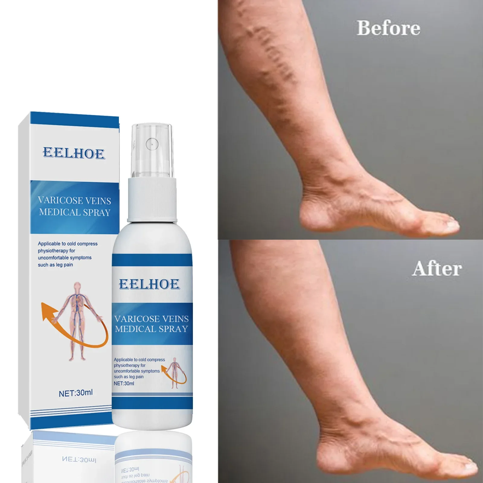 Venous Massage Spray for Relieving Varicose Veins, Smoothing The Bulge of Blood Vessels in Earthworm Legs Relieve Leg Pain