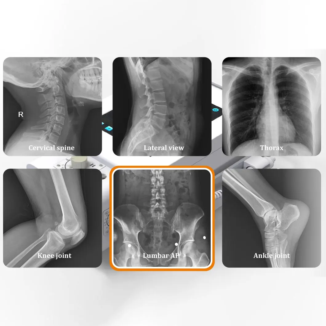 China Groothandel Hfx-08BS Raio X Draagbare Raio X Digitale Medische X Ray Prijs