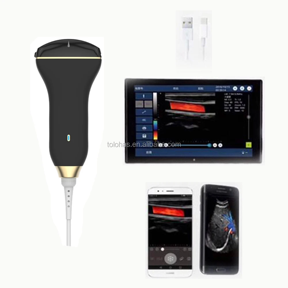 LHC30C Digital Color Doppler Ultrasound System / Color Doppler Ultrasonic Probe /Handheld Color Doppler