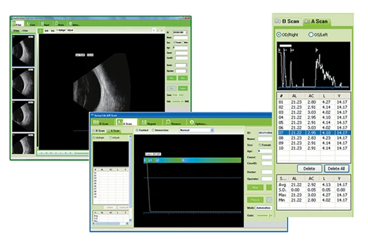 AIST SAB-500 Portable 15 Inch LED Touch Screen Ophthalmic Eye Ultrasound AB A B Scan