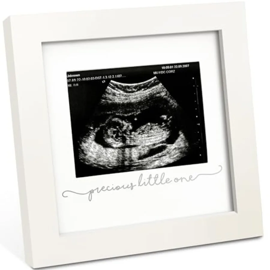 

Baby Sonogram Picture Frame - Modern Ultrasound Picture Frames for Mom to Be, First Pregnancy Gifts for Expecting Mom and First